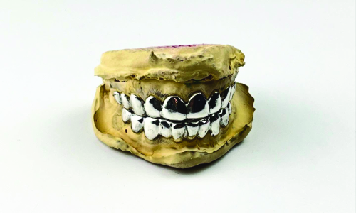 A sculpted jaw with detailed teeth and gums.